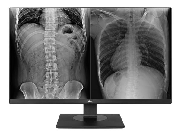 LG 27HJ713C-B Clinical Review Monitor - LED-Monitor - 8MP - Farbe - 68.6 cm (27")